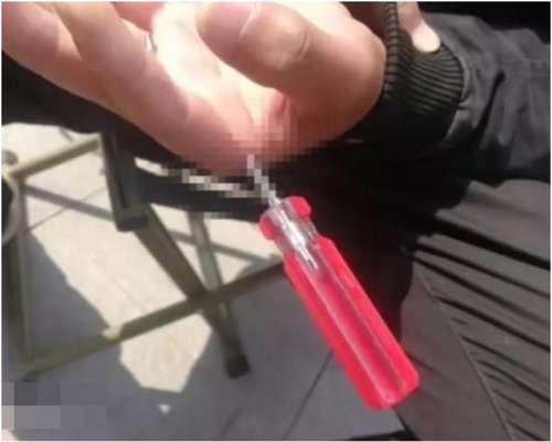 螺絲批差一點就穿掌而過。