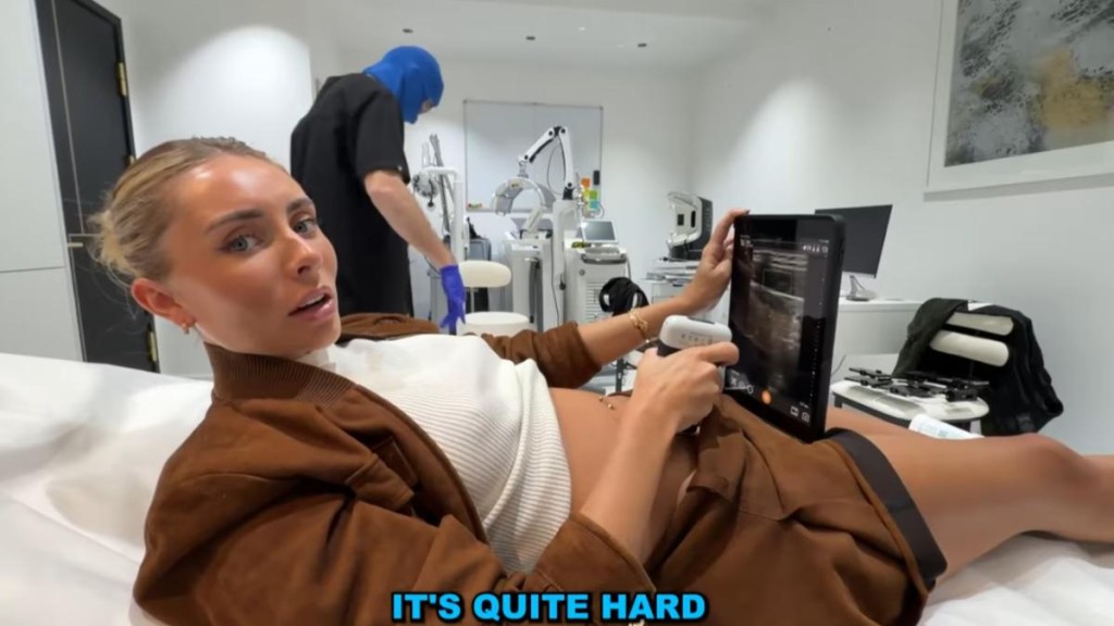 醫生依胎兒大小推估，受孕時間約在11至13天前，時間點恰與她進行無防護性行為挑戰的期間重疊。（YouTube@Bonnie Blue）