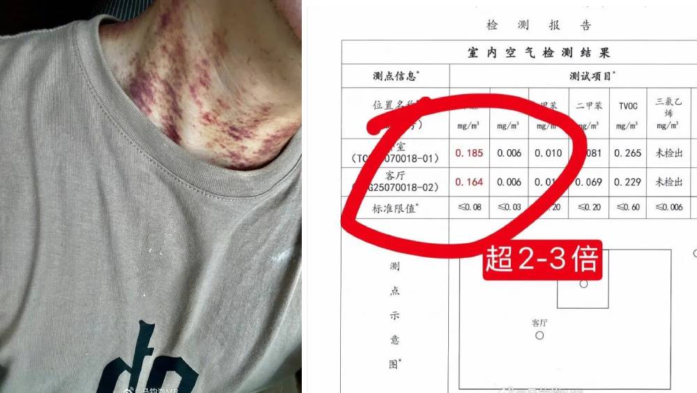 租客指¥6萬租「甲醛房」致病，冀退回按金不果，洩露房東私隱反被告。 