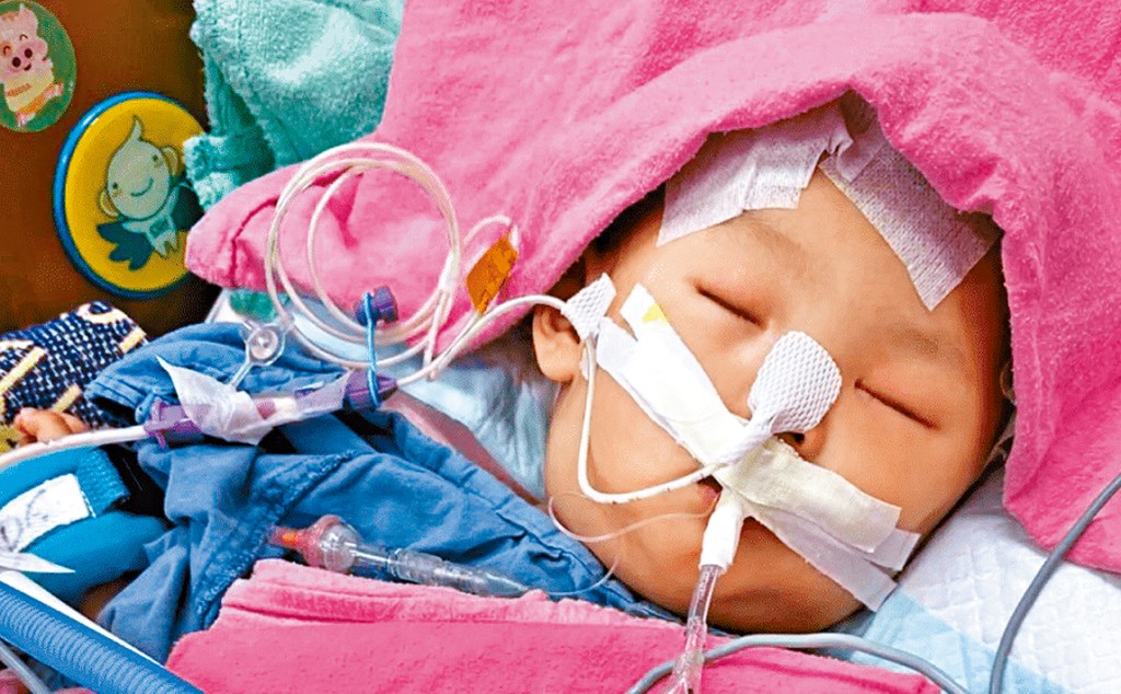 小雪兒出事前精靈可愛(上圖)，疑遭虐待須接受緊急開腦手術。