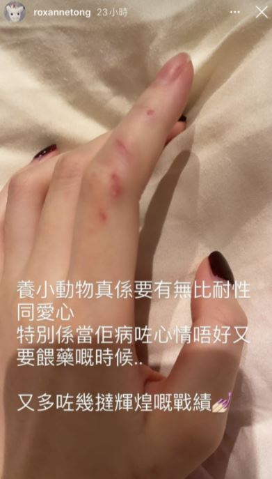 曾貼出左手被貓咬傷的戰績。