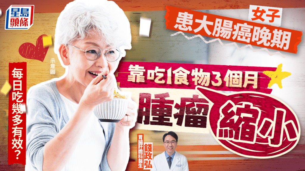 女子患大腸癌晚期 靠吃1食物3個月腫瘤縮小 每日吃幾多有效?