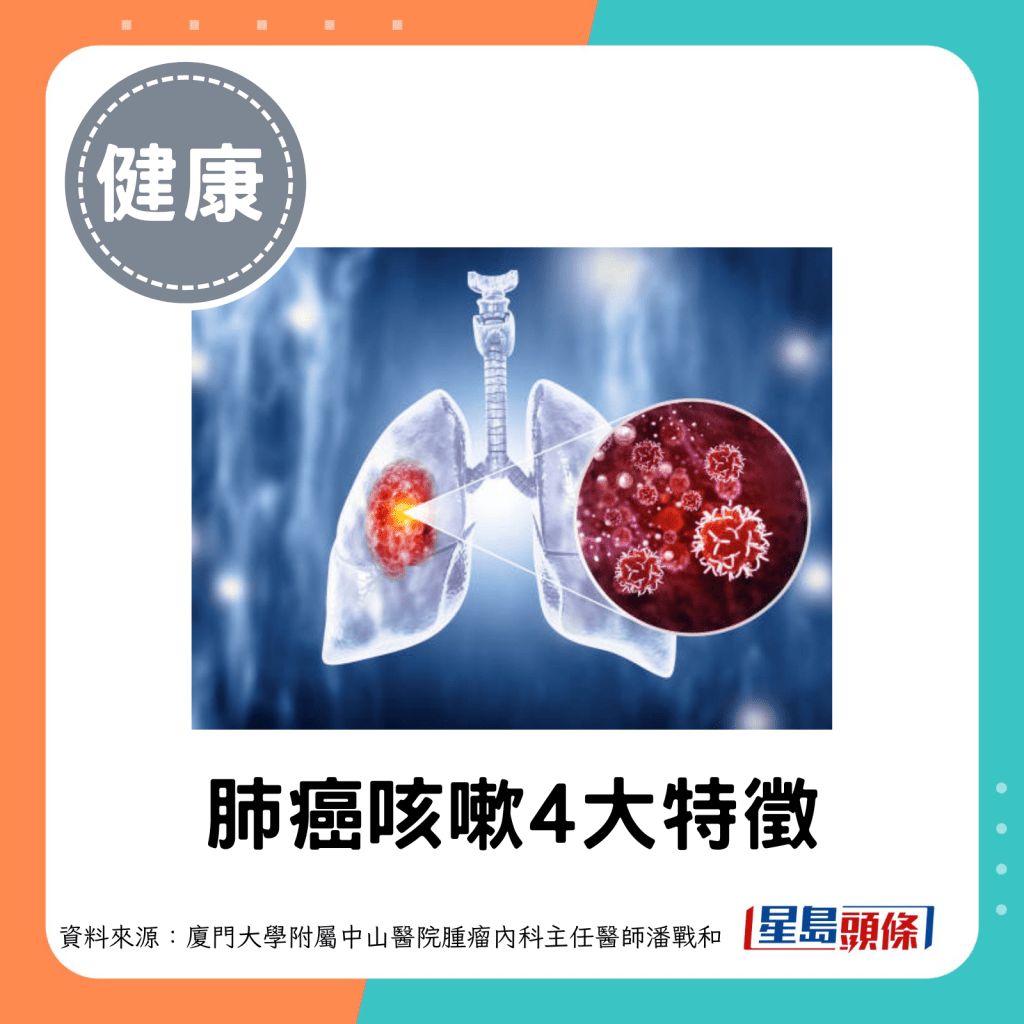 肺癌咳嗽4大特徵。