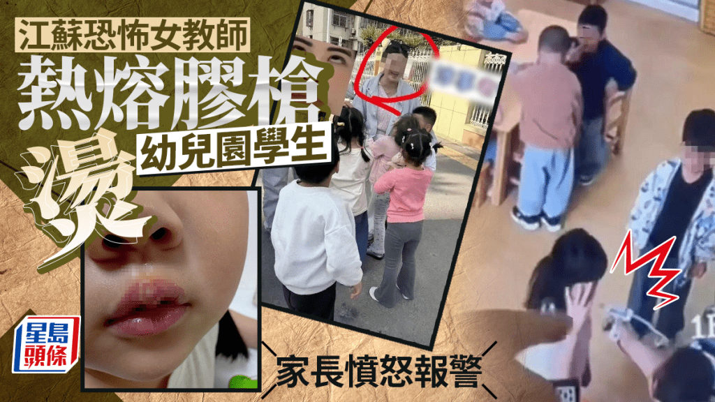 幼稚園虐童︱恐怖女教師熱熔膠槍當刑具  學生嘴唇流膿家長憤怒