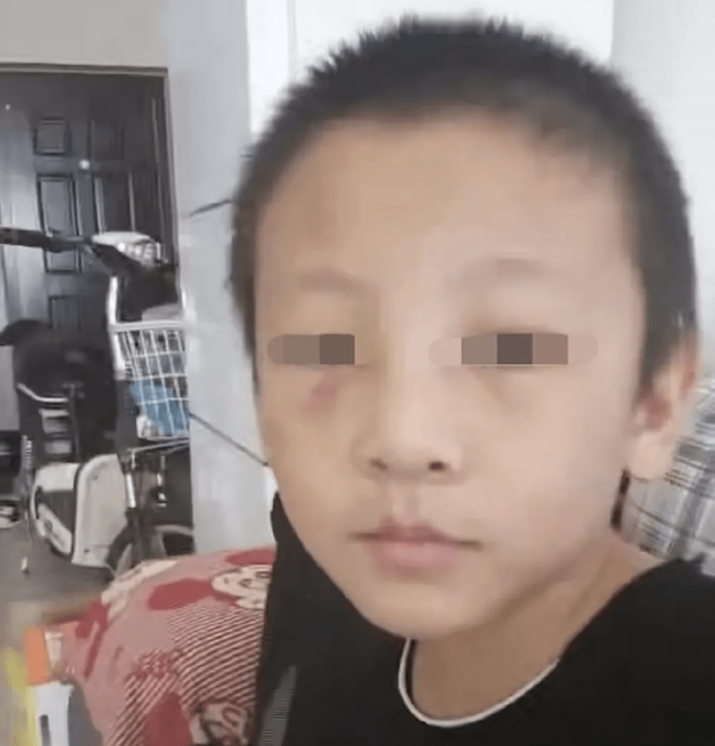 周二（20日）河南安陽市的張女士向媒體反映，她14歲的侄子張砷（化名）長期遭受親生父親與繼母虐待，2025年中秋節不幸離世。微信公眾號截圖