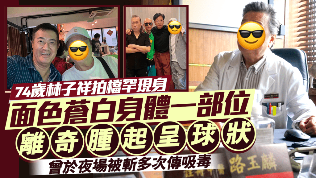 74歲林子祥拍檔罕現身   面色蒼白身體一部位離奇腫起呈球狀    曾於夜場被斬多次傳吸毒