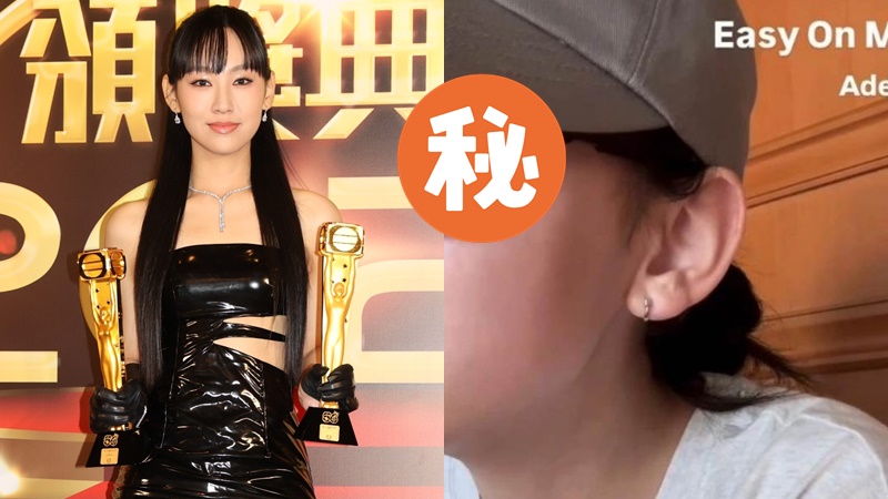 炎明熹驚爆傷眼貼紗布木無表情  左眼嚇現粒狀異物照片流出  一奇怪舉動安慰粉絲