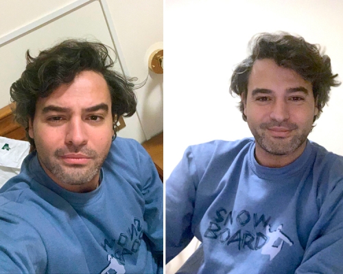 33歲羅馬律師Andrea Napoli憶述感染歷程,以及醫院慘況。AP