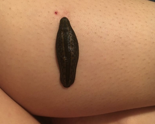 外國興起一股飼養水蛭熱潮。leechscapades IG