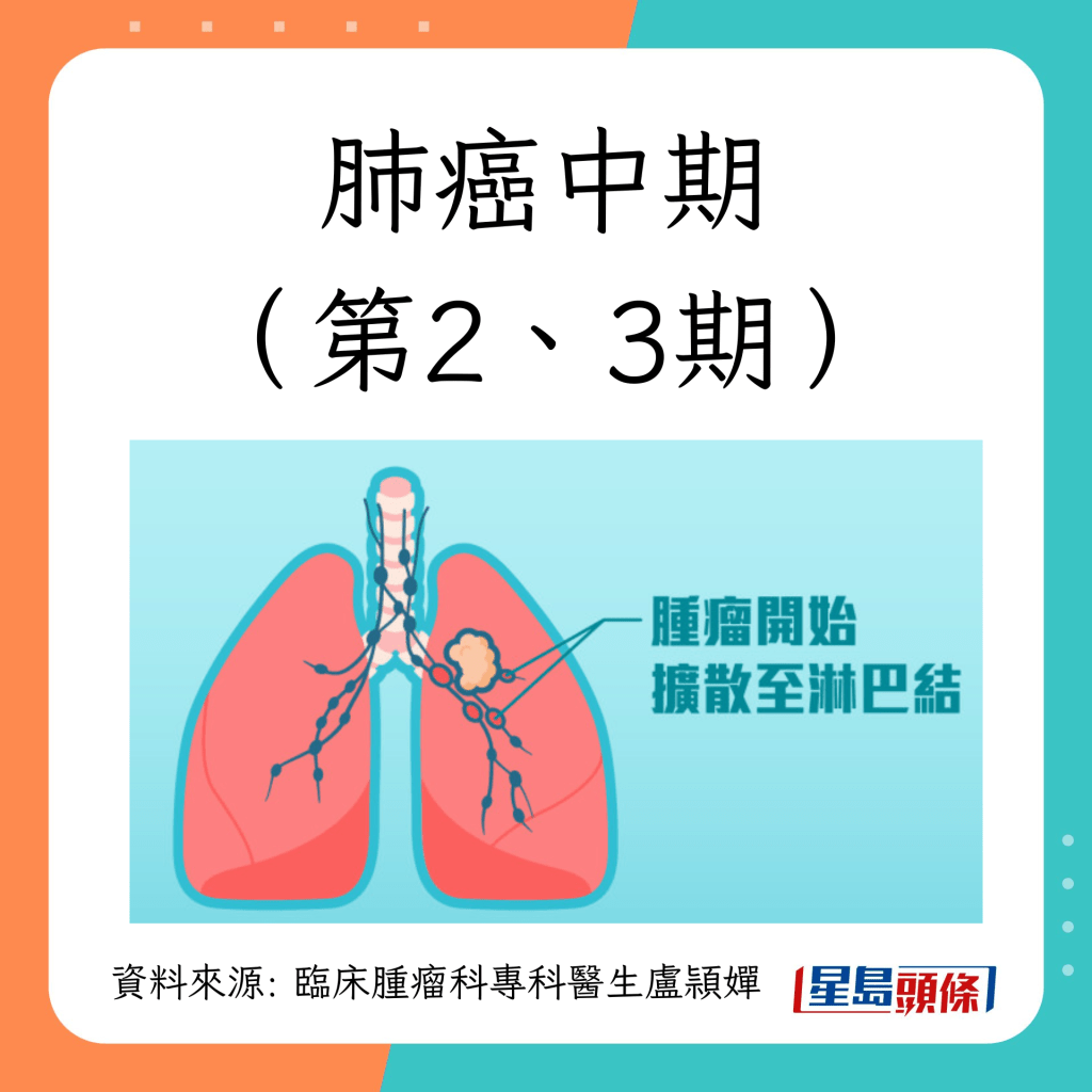 肺癌第1至4期治疗方法