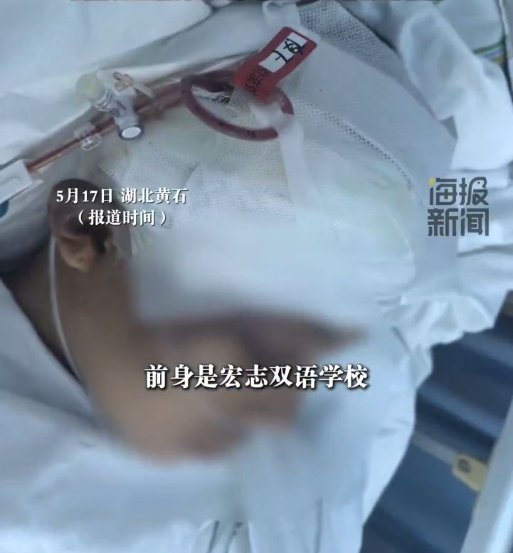 张先生送13岁儿子入读成长基地，儿子却被打至重伤。海报新闻