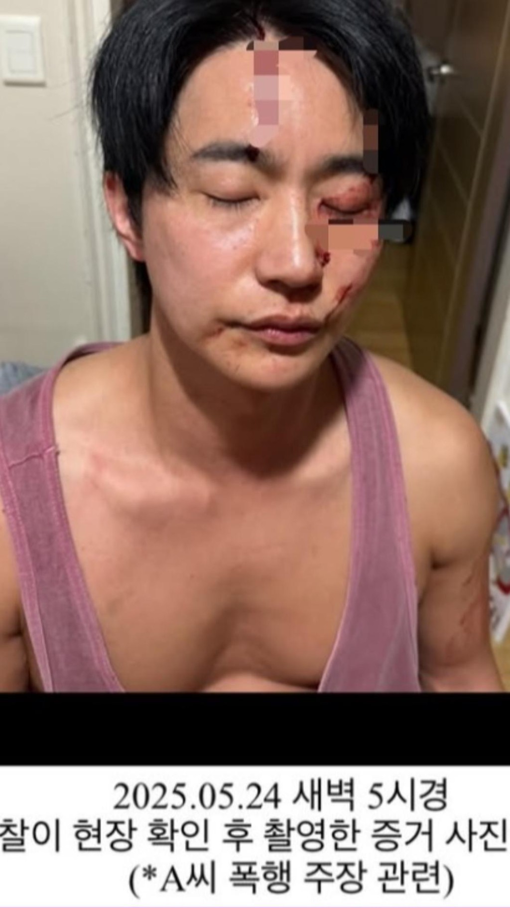 全浩俊晒出鼻青臉腫的照片回應。（TVBS新聞網圖片）