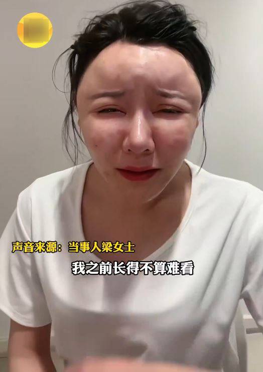 湖北的梁女士因在臉部注射生長因子變成面具人。起點新聞