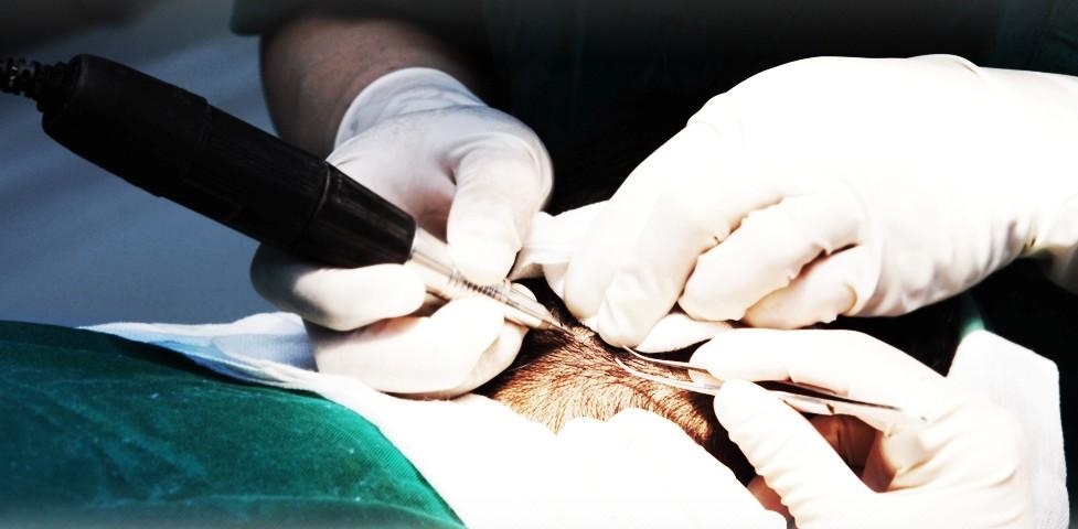 有经济学家判断,未来五年植发与防脱行业将难以摆脱「低研发、高营销」的模式,仅有极少数具备药企级研发能力的企业能成为例外。 有经济学家判断,未来五年植发与防脱行业将难以摆脱「低研发、高营销」的模式,仅有极少数具备药企级研发能力的企业能成为例外。