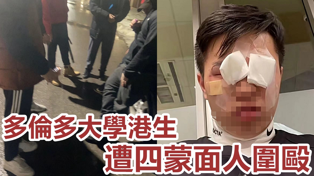 被圍毆的港生(右圖)面部敷上紗布,傷痕纍纍。