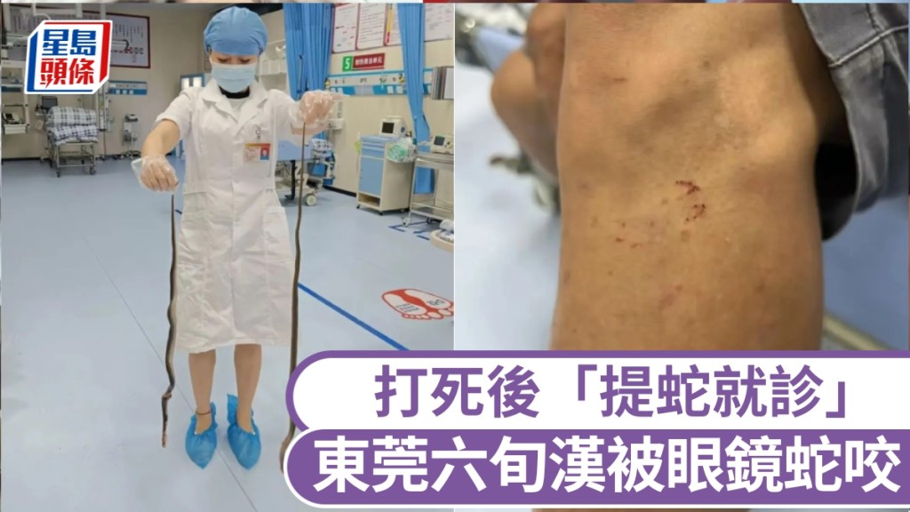 東莞六旬漢捕魚時被眼鏡蛇咬,打死後「提蛇就診」。