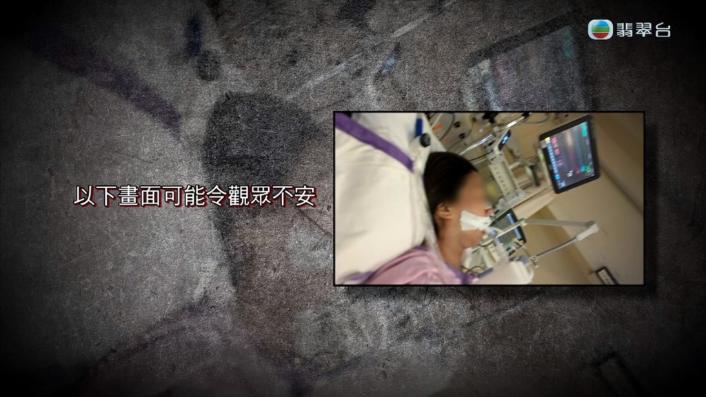 公立醫院的醫生為陳太檢查後，指陳太有機會醒不來，而且腸道有另一位置有損傷。
