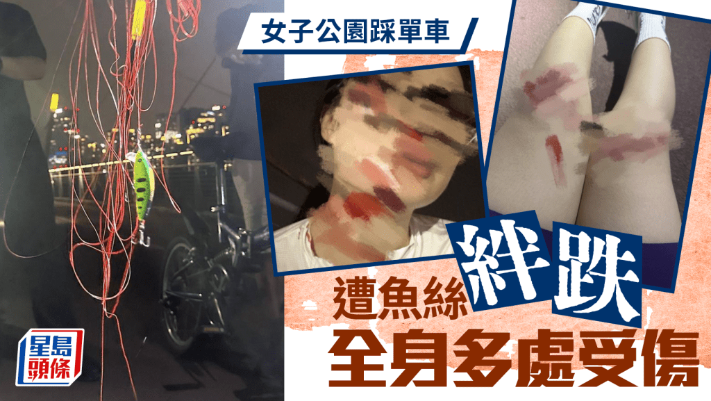 女子成都公園踩單車遭魚線絆飛 面部周身多處受傷