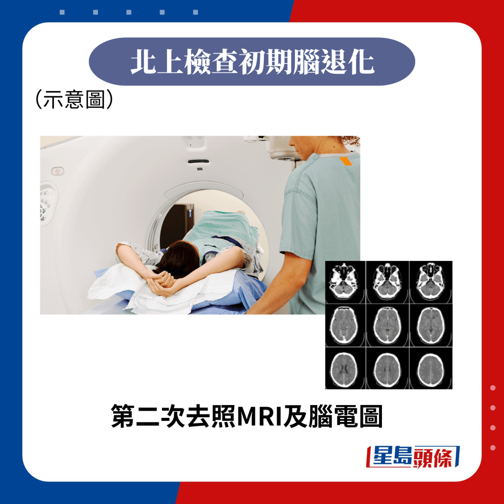 第二次去照MRI及腦電圖