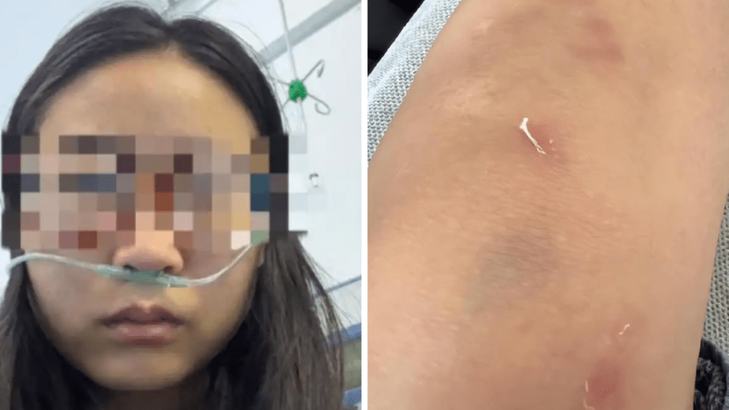 內蒙古女子稱討薪遭老闆夫婦毆打。紅星新聞