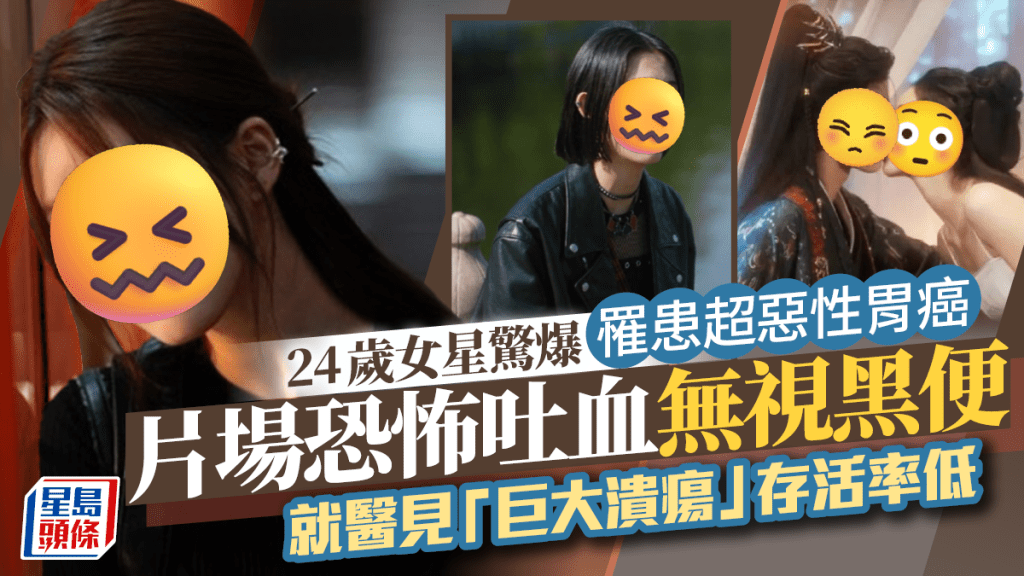 24歲女星驚爆罹患超惡性胃癌 片場恐怖吐血無視黑便 就醫見「巨大潰瘍」存活率低