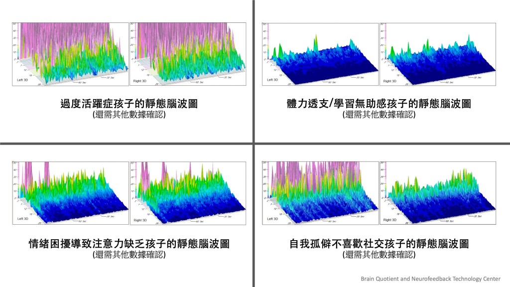 从脑电波图,可以看到孩子在静态时的脑袋 运作,变相可以了解他当时在想甚么。(图片由受访者提供) 从脑电波图,可以看到孩子在静态时的脑袋 运作,变相可以了解他当时在想甚么。(图片由受访者提供)