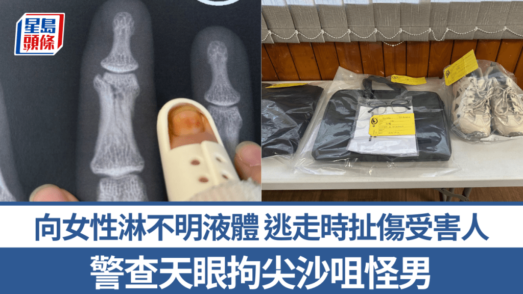 Threads瘋傳尖沙咀電梯怪漢出沒 三度向女性淋不明液體 警拘26歲IT男