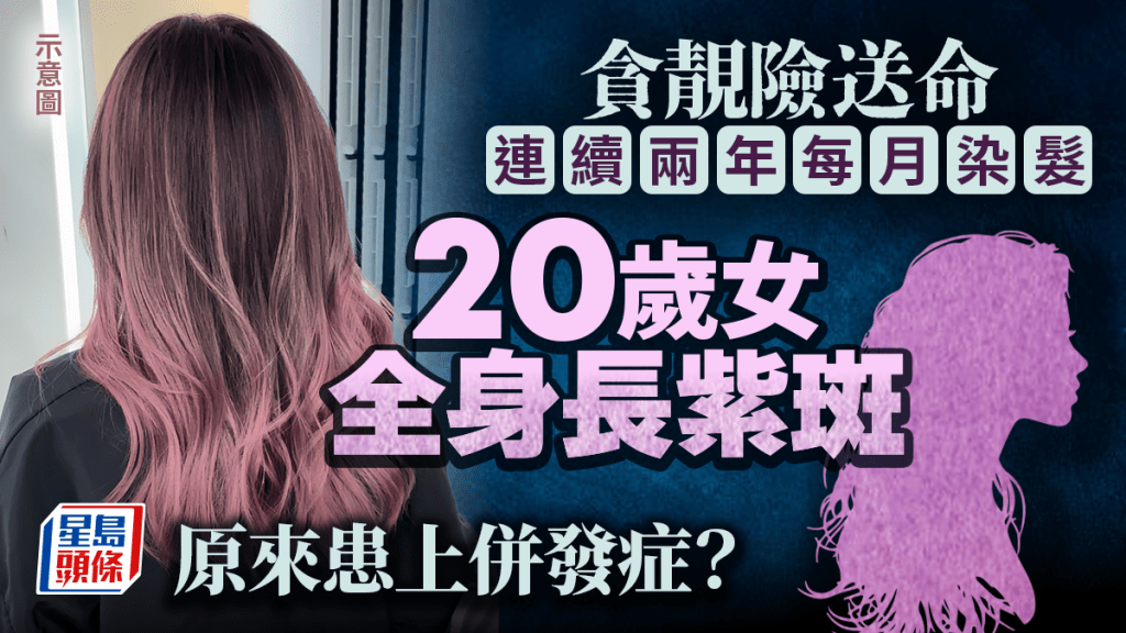 「染髮控」渾身長滿紫斑 廿歲女慘要剃光頭因患上......