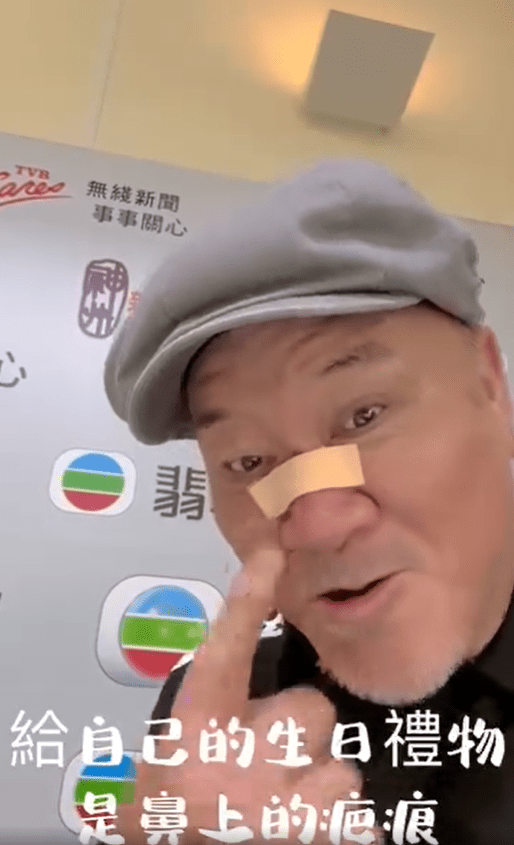 當日鄭恕峰的鼻樑仍貼着膠布出席TVB 4月之星的生日會，字幕更出現：「給自己的生日禮物是鼻上的疤痕」。