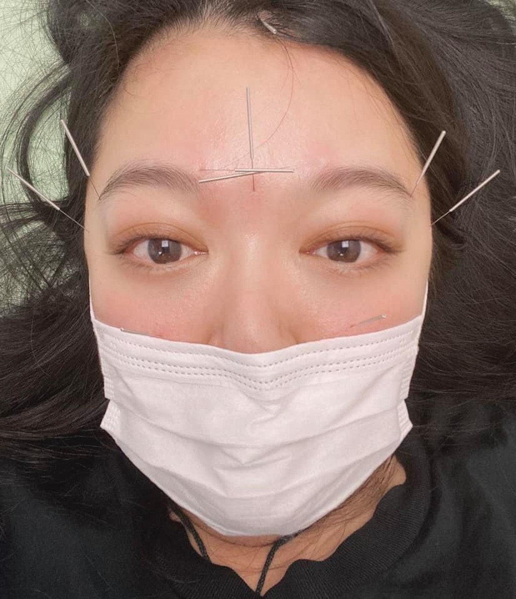 珊珊曾中西合璧治病。 珊珊曾中西合璧治病。