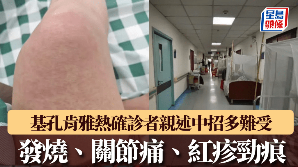 順德基孔肯雅熱確診者親述中招多難受，指醫院爆滿患者。