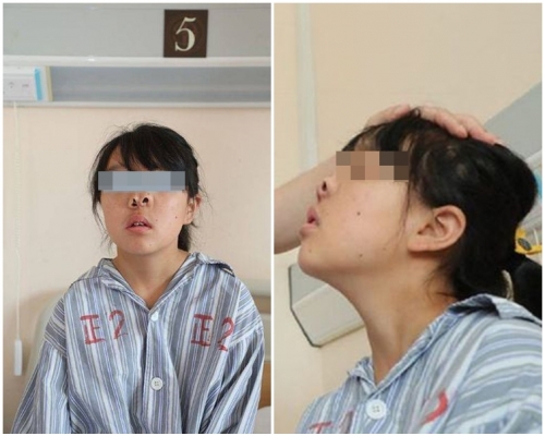 小梅手术后终于能用鼻呼吸。网图
