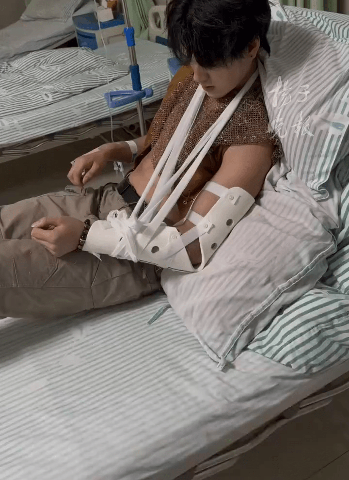 被「出術」遊客拗手瓜「斷臂」NPC正在努力維權。 被「出術」遊客拗手瓜「斷臂」NPC正在努力維權。