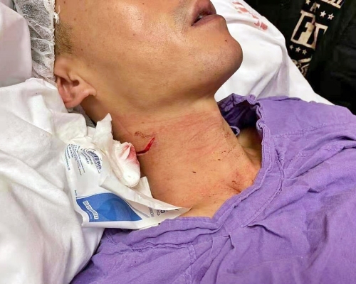 遇襲警員右邊頸部有3至4厘米的傷痕，並傷及頸部靜脈及神經線。網圖