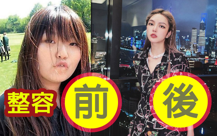 周揚青曾大方承認整容。