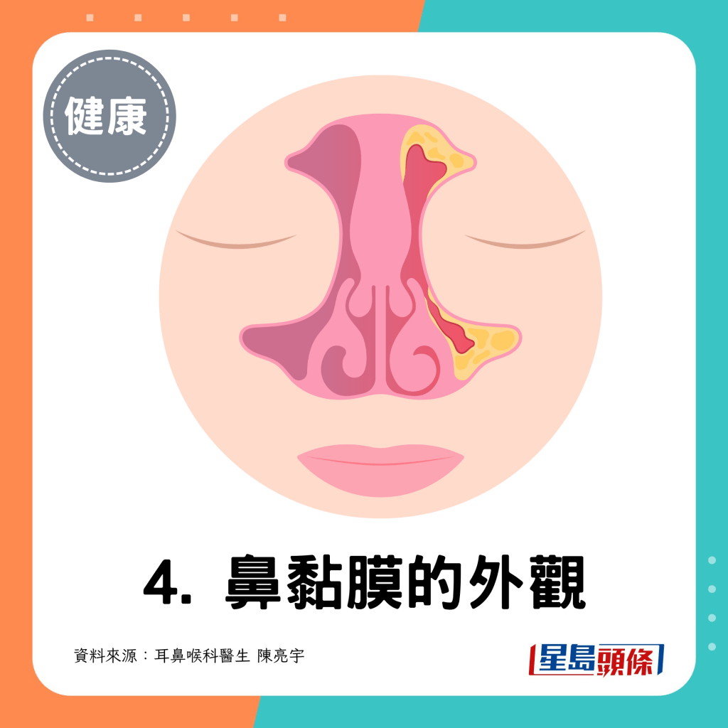 4. 鼻黏膜的外觀