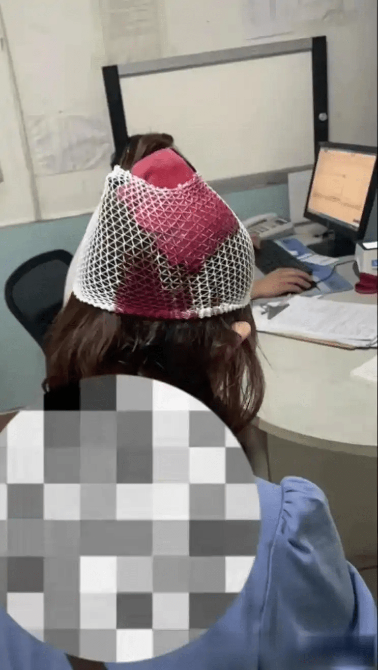 愛害中介頭部受傷照片。 愛害中介頭部受傷照片。