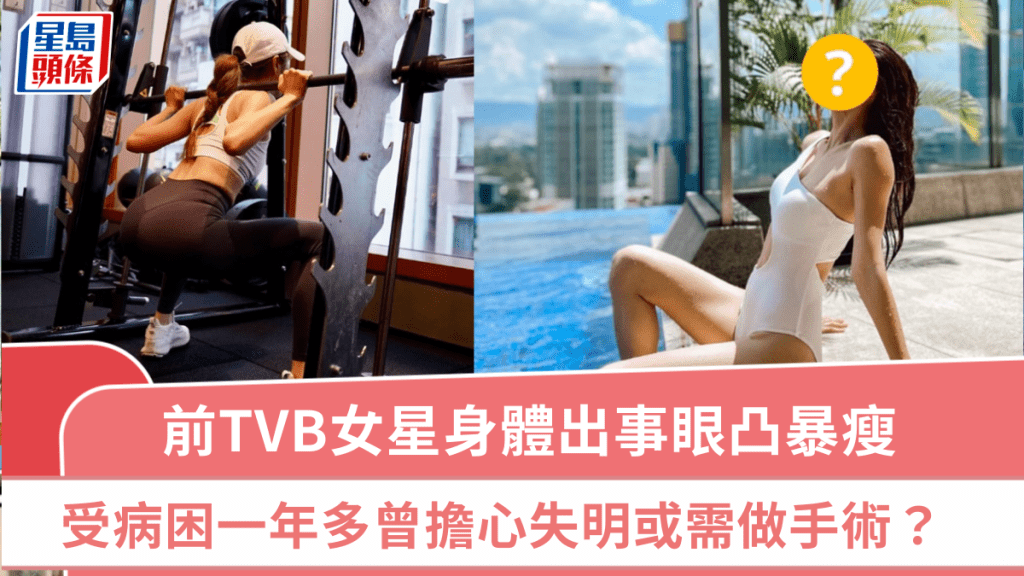 前TVB女星身體出事眼凸暴瘦  受病困一年多曾擔心失明  透露現況或需做手術？