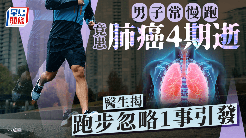男子常慢跑養生 竟患肺癌4期逝 醫生揭跑步忽略1事引發