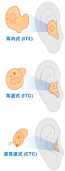 塞進耳朵裡的「耳內式 / 耳道式 / 深耳道式」(ITE / ITC / CIC) 塞進耳朵裡的「耳內式 / 耳道式 / 深耳道式」(ITE / ITC / CIC)