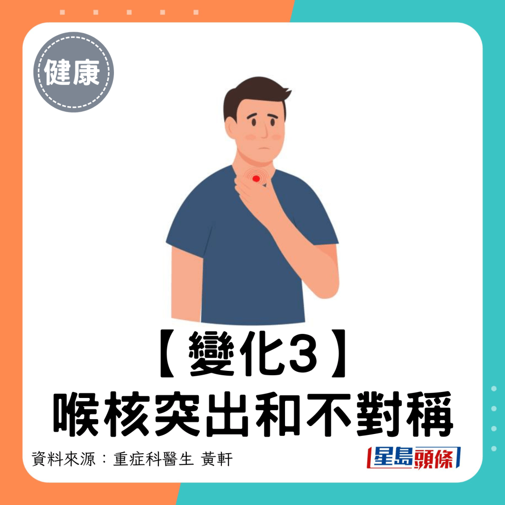 3. 喉核突出和不对称