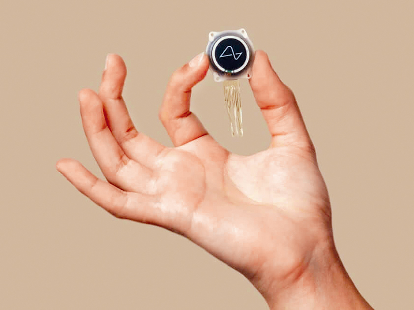 Neuralink的大腦晶片。 Neuralink的大腦晶片。