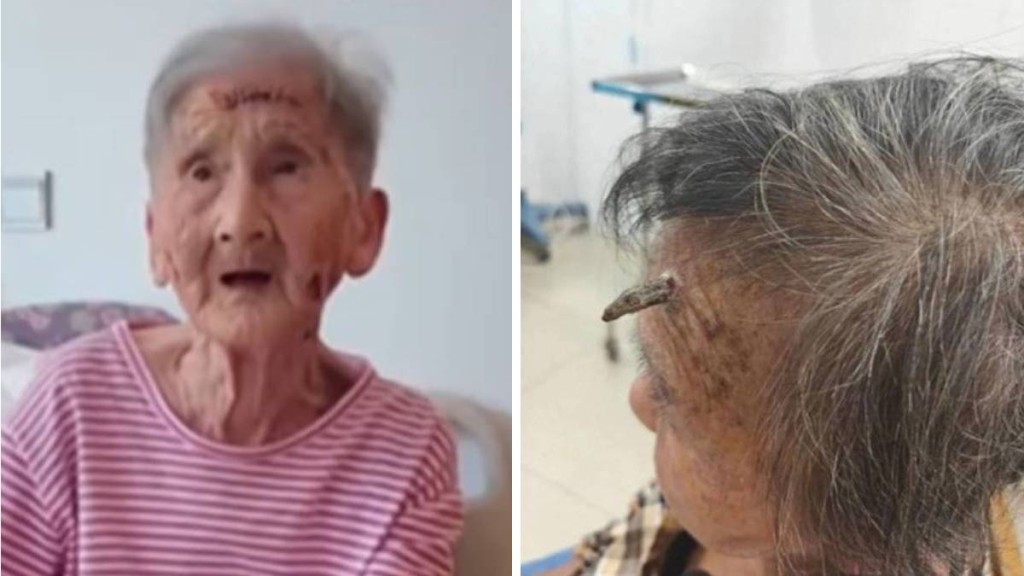 顧婆婆自行剪去額上犄角，險致大出血。環球網／長城新媒體