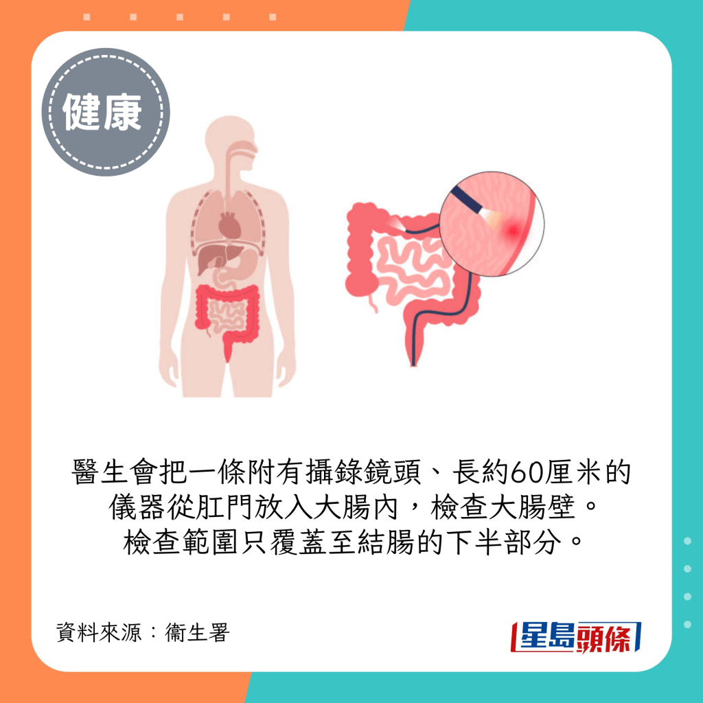 醫生會把一條附有攝錄鏡頭、長約60厘米的儀器從肛門放入大腸內，檢查大腸壁。檢查範圍只覆蓋至結腸的下半部分。