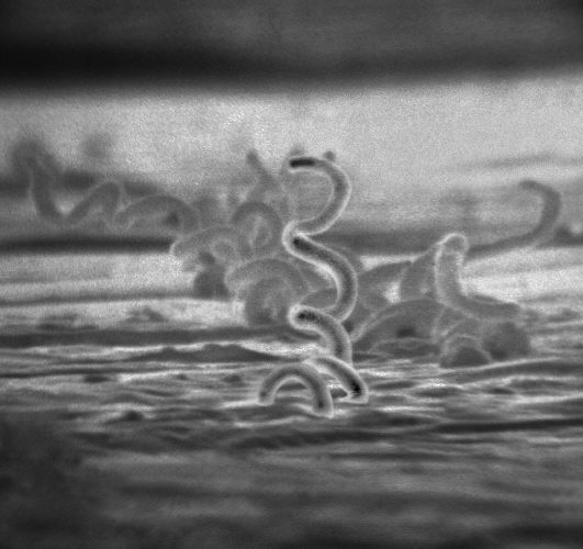 梅毒螺旋體的電子顯微照片。 Wiki