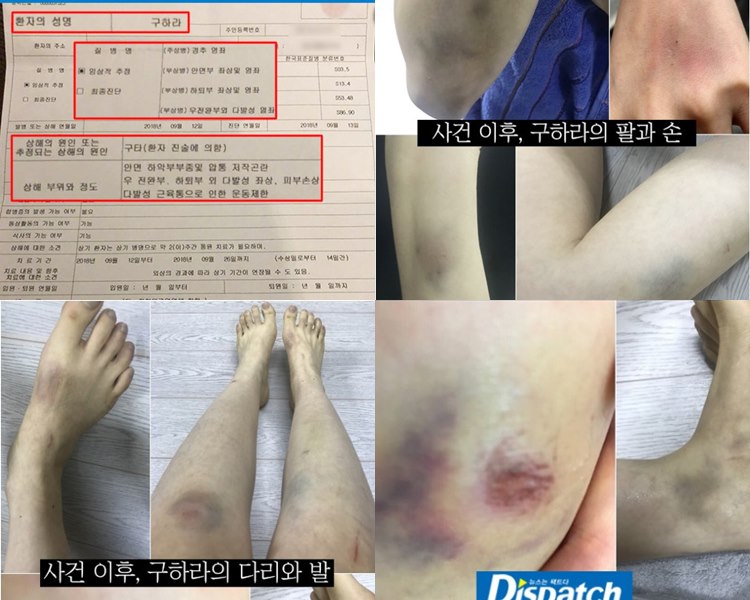 具荷拉稱被打到子宮出血,手腳有瘀傷。