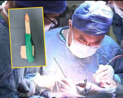 女童被陶瓷刀插入眼內,需要動手術取出碎片。互聯網圖片