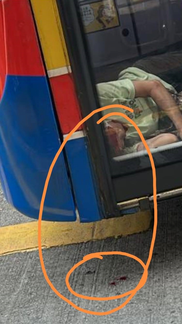 受傷女乘客頭部重創浴血,鮮血更由車門縫隙滴出馬路。FB:馬路的事討論區 受傷女乘客頭部重創浴血,鮮血更由車門縫隙滴出馬路。FB:馬路的事討論區
