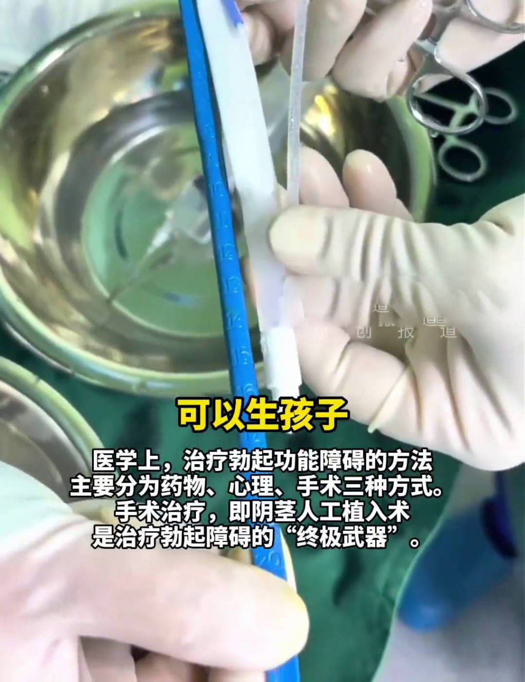 六旬漢植入17.5cm陰莖假體。 長江雲