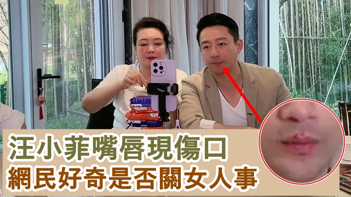 汪小菲如何受傷,網民好關心。